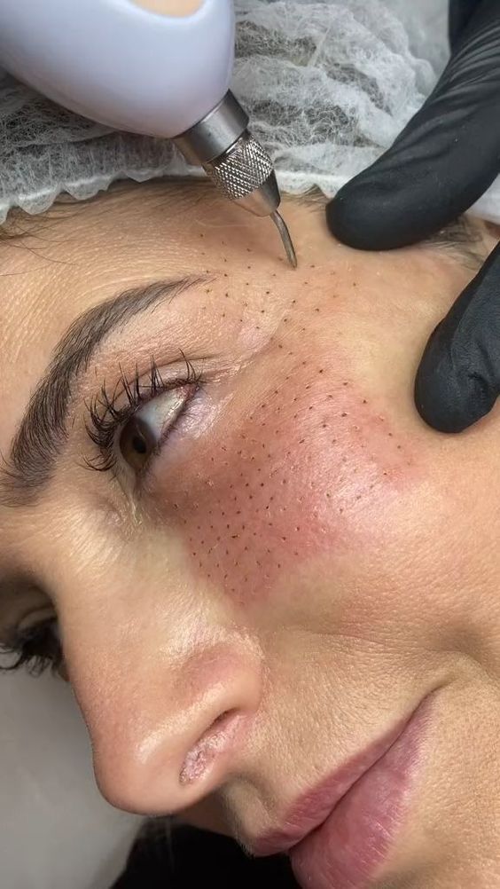 Nutrición y Regeneración Orbicular